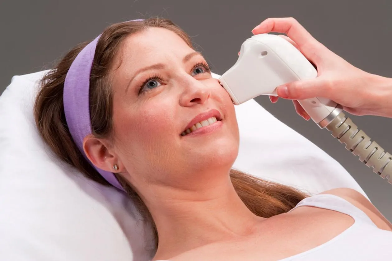 Thermage FLX San Jose | RF Skin Tightening | NSM